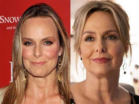 Melora Hardin Plastic Surgery: Boob Job, Botox and Facelift